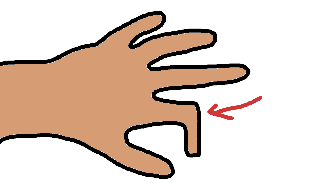A finger has a 90 degree sideways bend in it